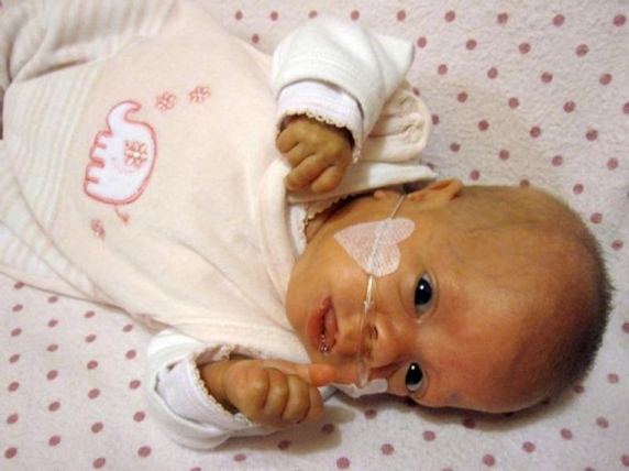 Hazavihették szülei a 280 grammal született Hazavihették szülei a 280 grammal született